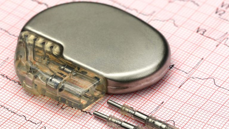 Insert molding: process, applications, and benefits